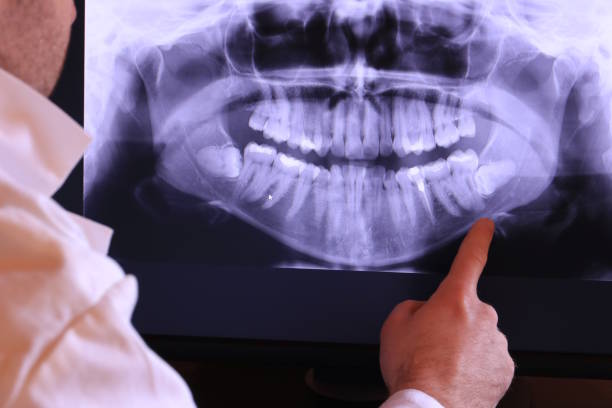 Best Broken or Cracked Tooth Emergency Dentist in Laguna Heights, TX