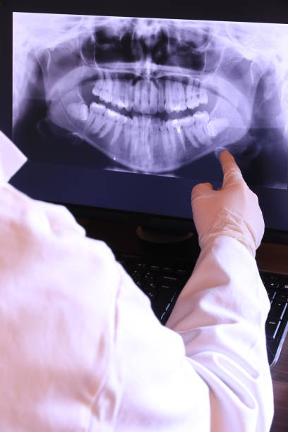 Best Emergency Dental Extractions in Laguna Heights, TX