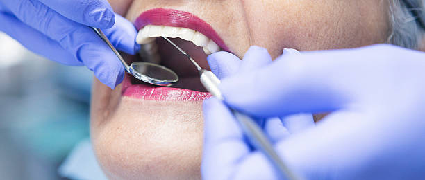 Best Emergency Dental Care for Abscessed Tooth in Laguna Heights, TX